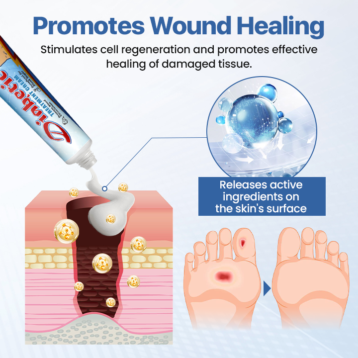 Tired of Swollen Feet, Itchy Skin & Constant Infection Worries? This Cream Was Made For You