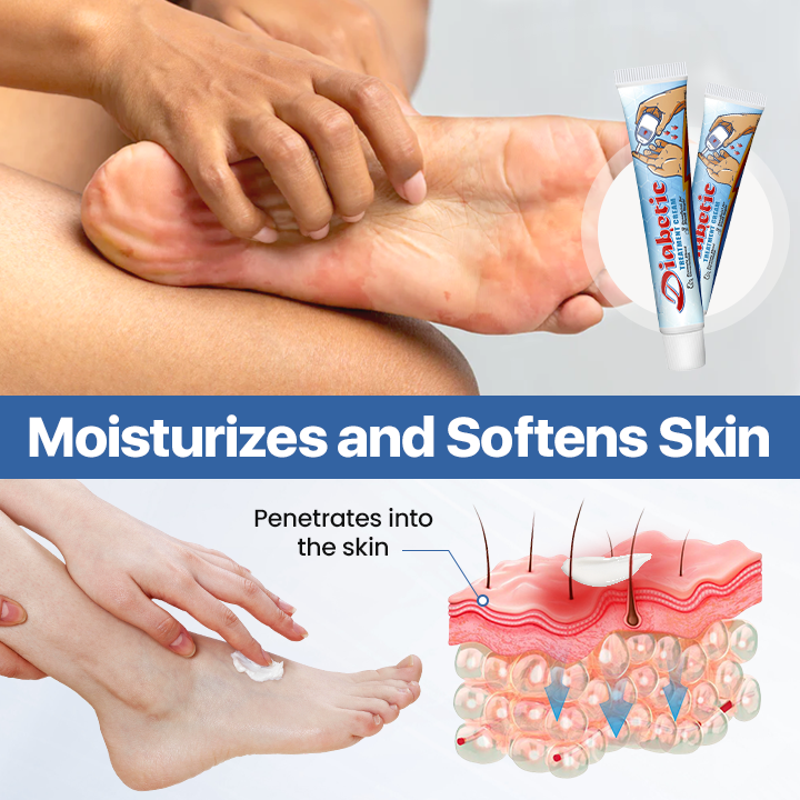 Tired of Swollen Feet, Itchy Skin & Constant Infection Worries? This Cream Was Made For You